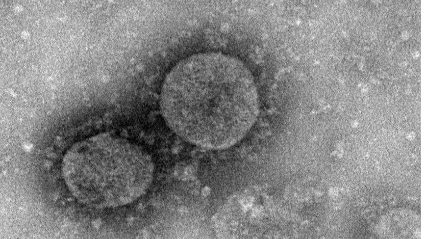 Korona virusom zaraženo oko 78.000 ljudi