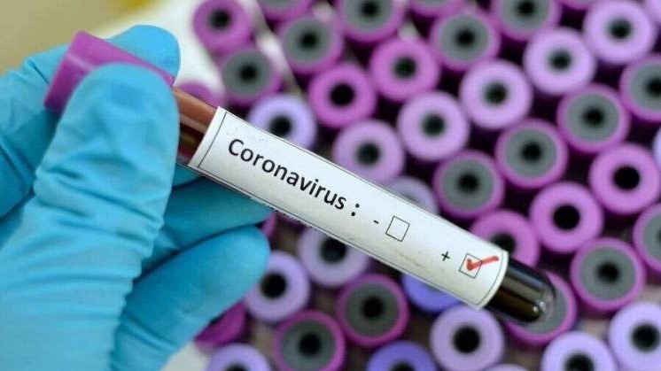 SAD - Devet osoba umrlo od koronavirusa