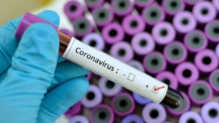 Dvije žene preminule od posljedica koronavirusa u RS