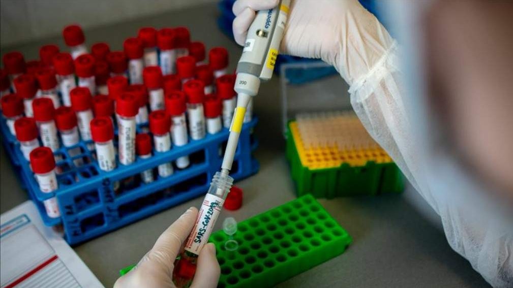 WHO pozdravio rezultate ispitivanja vakcine na Univerzitetu Oxford