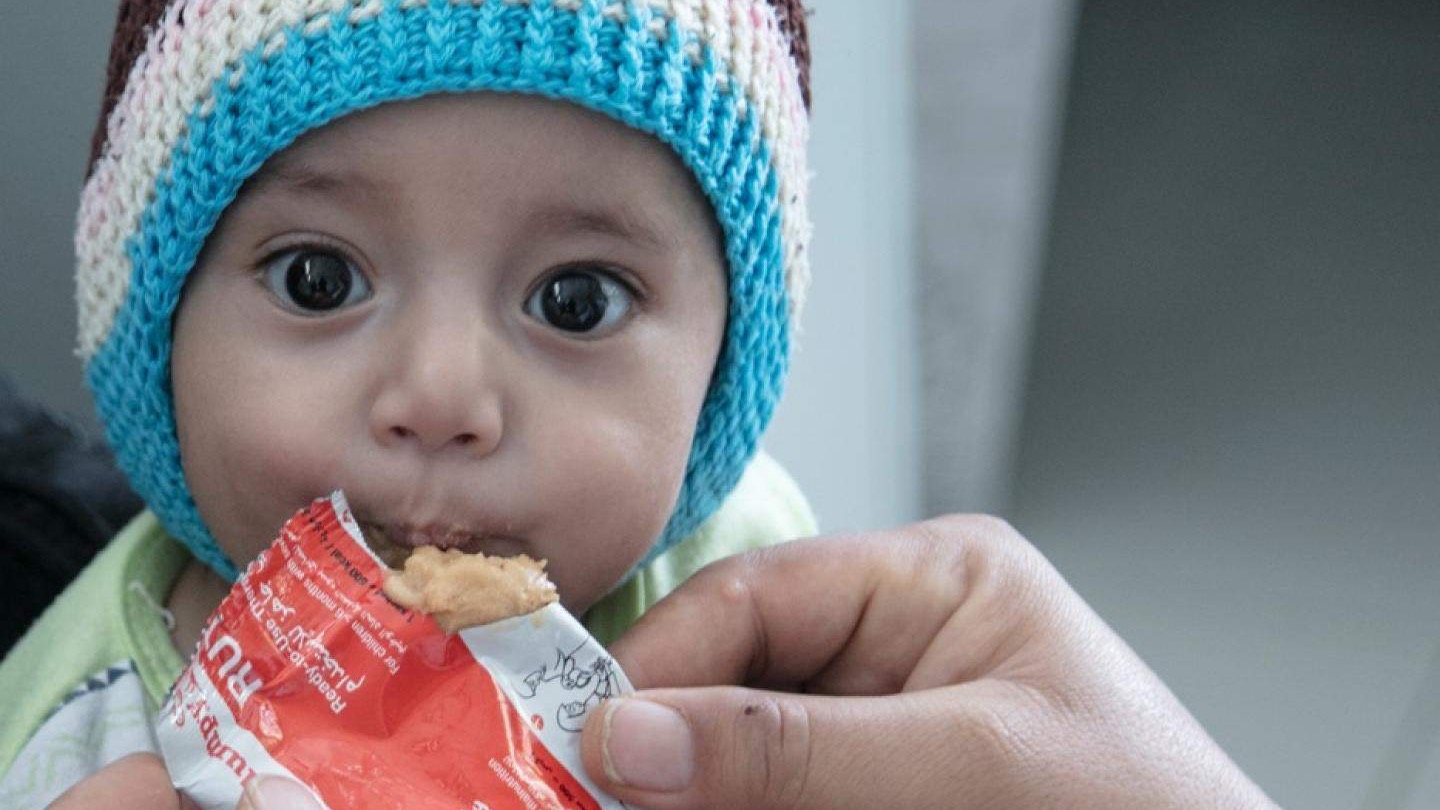 UN: Pola miliona djece u Jemenu suočava se s akutnom pothranjenošću